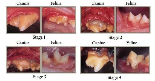 teeth-with-staging